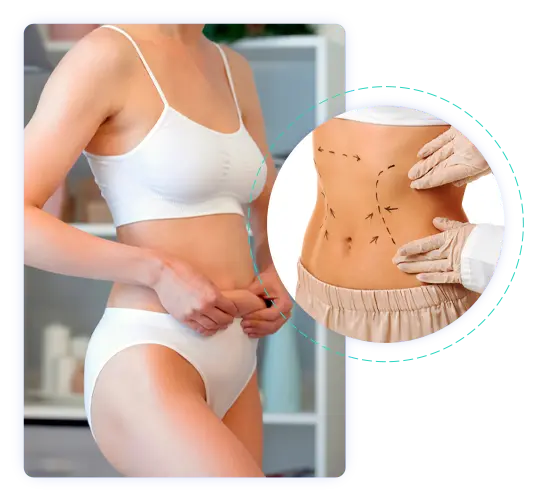 Abdominoplastie en Tunisie