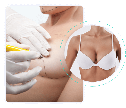 Chirurgie seins Tunisie